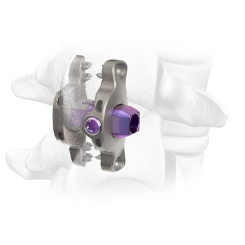 Dr. Burak Ozgur Discusses the Expanded Commercial Release of the Clutch® Interspinous Process Device